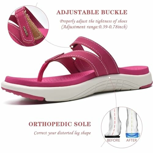 Pink orthopedic sandals with adjustable buckle and sole.